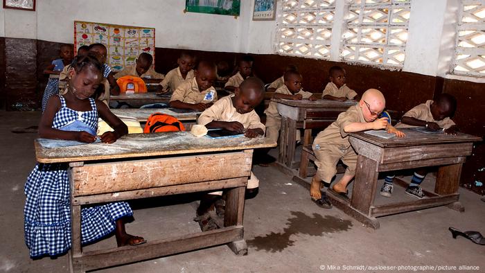 In classroom near Abidjan with a dozen students, one boy is seen with albinism