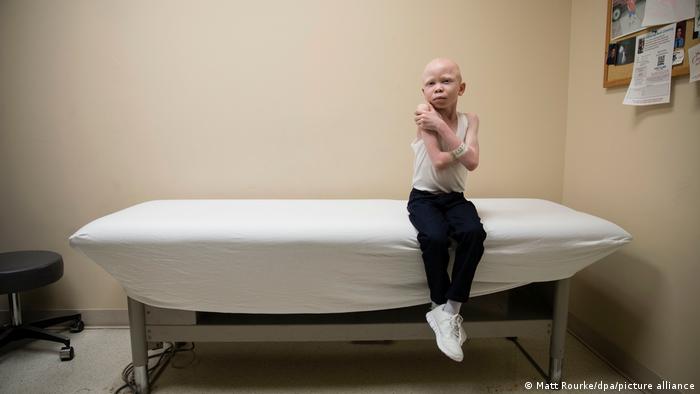 A young boy with albinism sits on a stretcher at a doctor's surgery in Philadelphia