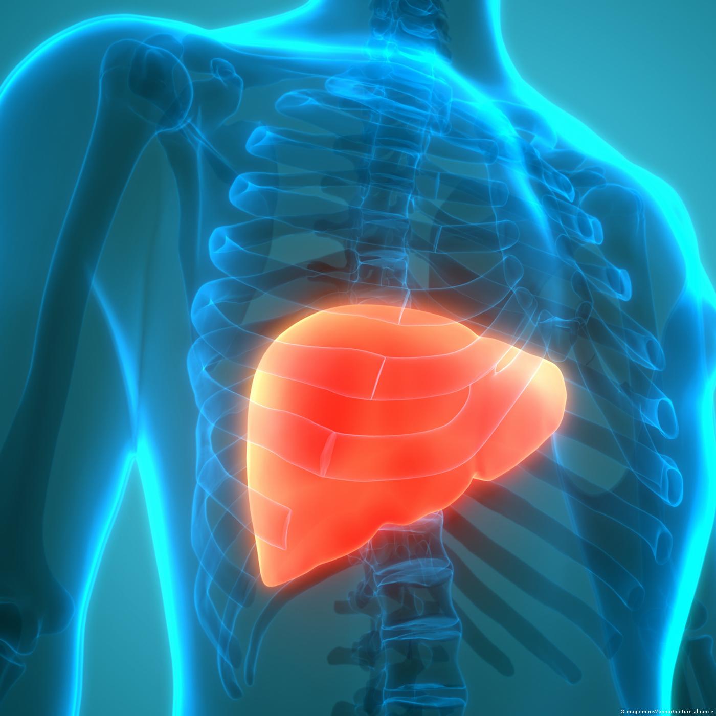 La cirrhose du foie, une maladie silencieuse