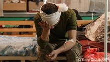 A newly arrived wounded soldier waits for treatment in a room of the military hospital in Zaporizhzhya, on March 31, 2022, amid Russian invasion of Ukraine. (Photo by emre caylak / AFP)