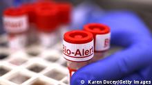 SEATTLE, WA - JULY 12: The top of a swab specimen containing Monkeypox virus is labeled Bio Alert at the UW Medicine Virology Laboratory on July 12, 2022 in Seattle, Washington. The UW Medicine Virology Laboratory is one of a handful of clinical reference labs in the country to offer laboratory-developed PCR tests for the detection of Monkeypox virus. (Photo by Karen Ducey/Getty Images)