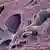Prostate cancer magnification image