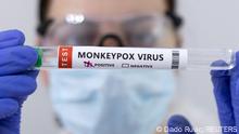 FILE PHOTO: Test tubes labelled Monkeypox virus positive are seen in this illustration taken May 23, 2022. REUTERS/Dado Ruvic/Illustration/File Photo
