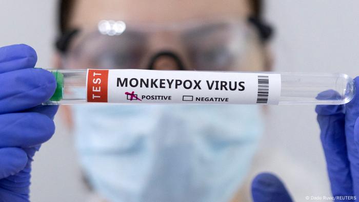 Positivo al virus del mono, dice la etiqueta del tubo de donde se obtuvo la prueba. 