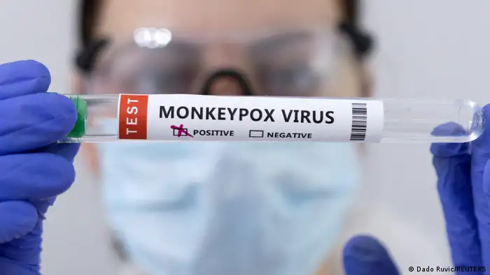 美國一個猴痘疫苗檢測呈陽性的試管（資料照）