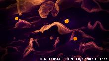 In this image: A scanning electron micrograph shows Nipah virus (yellow) budding from the surface of a cell.
