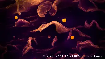 尼帕病毒的显微图象