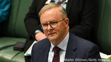 CANBERRA, AUSTRALIA - JULY 28: Australian Prime Minister Anthony Albanese reacts during Question Time at Parliament House on July 28, 2022 in Canberra, Australia. The 47th parliament is sitting for the first time this week following Labor's victory over the Coalition government in the Australian Federal Election on May 21. (Photo by Martin Ollman/Getty Images)