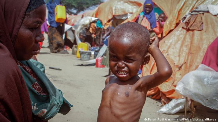 Somalia, criză alimentară