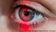 ILLUSTRATION - Das Auge eine Frau wird am 01.07.2016 in Berlin von einem roten Licht angestrahlt. Foto: Henrik Josef Boerger