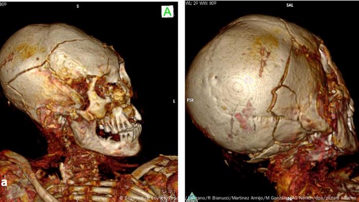 TAC 3D del cráneo de la momia masculina de Délémont. 