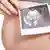 Foto simbólica de una mujer embarazada que muestra una imagen de ultrasonido.