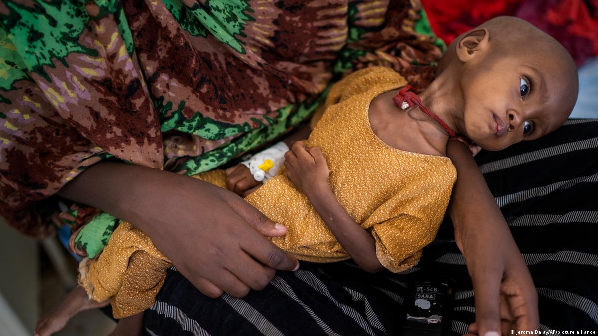 ډېر خلک لا دمخه له قحطۍ څخه تښتي. د ډولو ښارګوټي په څنډه کې د پلاستیک او د ونو له څانګو څخه جوړي شوي لنډ مهاله خیمې ایښودل شوي دي. حمدي یوسف او مور یې هم هلته بند پاتې دي. کوچنى حمدي په سخته خوارځواکۍ اخته دى. په کمپ کې ګاونډیان دوی ته خواړه چمتو کوي. د ملګرو ملتونو د ماشومانو د وجهي صندوق یونیسف په وینا، په دې وروستیو کې څه باندې ۷۰۰ سومالیايې هلکان او نجونې د لوږې له امله مړه شوي دي. ډېر خلک لا دمخه له قحطۍ څخه تښتي. د ډولو ښارګوټي په څنډه کې د پلاستیک او د ونو له څانګو څخه جوړي شوي لنډ مهاله خیمې ایښودل شوي دي. حمدي یوسف او مور یې هم هلته بند پاتې دي. کوچنى حمدي په سخته خوارځواکۍ اخته دى. په کمپ کې ګاونډیان دوی ته خواړه چمتو کوي. د ملګرو ملتونو د ماشومانو د وجهي صندوق یونیسف په وینا، په دې وروستیو کې څه باندې ۷۰۰ سومالیايې هلکان او نجونې د لوږې له امله مړه شوي دي.