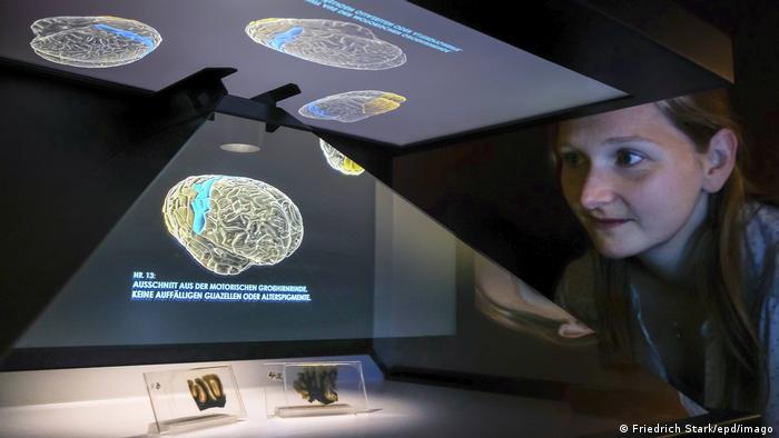 Una mujer observa dos secciones histológicas del cerebro de Albert Einstein, prestadas por el Museo Muetter de Filadelfia (EE. UU.) al Museo de Historia Natural LWL de Muenster en 2018.