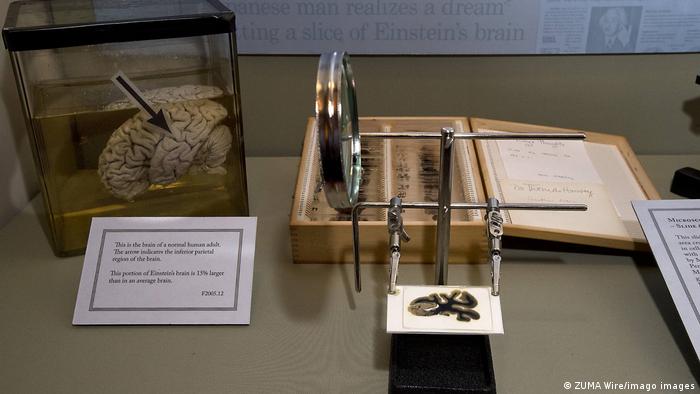 Un ejemplar del cerebro de Albert Einstein se encuentra en el Museo Mutter del Colegio de Médicos de Filadelfia 