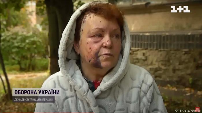 Screenshot eines TV-Beitrag des ukrainischen Fernsehsenders 1+1: Oleksandra Kyselyova, Verwundete vom Raketenanschlag am 10. Oktober in Kiew (Quelle: 1+1)