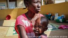 UN: 30 Millionen Kinder sind vom Hungertod bedroht