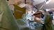 spine surgery being performed at a hospital in southwestern Germany