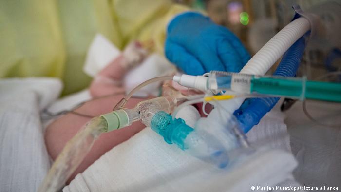 Ένα μωρό βρίσκεται σε ένα κρεβάτι νοσοκομείου συνδεδεμένο με σωλήνες.