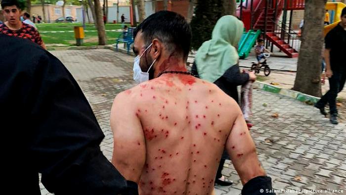 En Iran, un manifestant a le dos criblé de balles