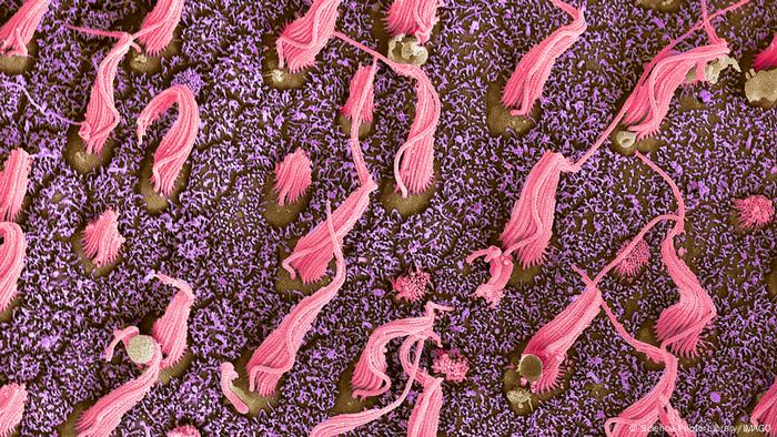 A pesar de su papel en el movimiento, ya sea empujando a las células o moviendo materiales cerca de su superficie, la mayoría de los cilios del cuerpo humano no son móviles.