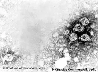 L'hépatite B : un virus 100 fois plus infectieux que le VIH sida