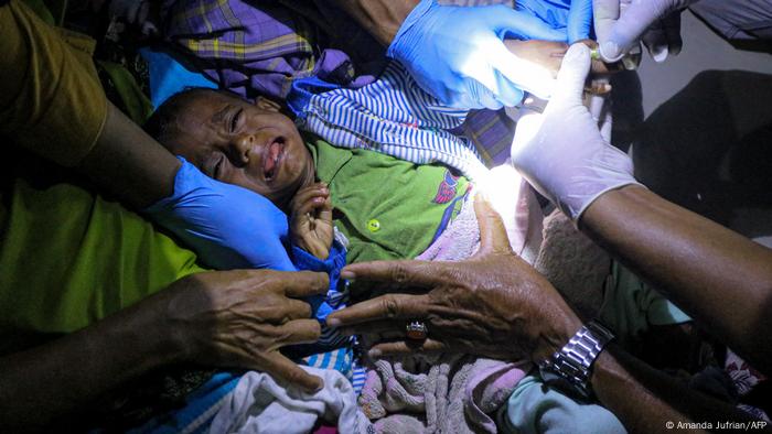 Foto de un niño rohinyá que es atendido por personal de emergencia en Indonesia.