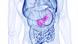 Durchsichtige Frontalaufsicht auf menschlichen Oberkörper. Organe sind dunkelblau angedeutet. Das Pankreas liegt in der Mitte der Bauchhöhle zwischen den anderen Organen und ist pink markiert. Durchsichtige Frontalaufsicht auf menschlichen Oberkörper. Organe sind dunkelblau angedeutet. Das Pankreas liegt in der Mitte der Bauchhöhle zwischen den anderen Organen und ist pink markiert.