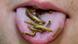 Mealworm larvae on a person's tongue Mealworm larvae on a person's tongue