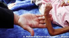 أطفال اليمن في خطر محدق.. وتحذير من مغبة تصعيد الحوثيين في مأرب