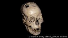 Human skull with evidence of trepanning. A once common procedure, trepanning was believed to be useful in alleviating headaches and relieving pressure on the brain amongst other things. Jericho, 2000 BC. (World History Archive)