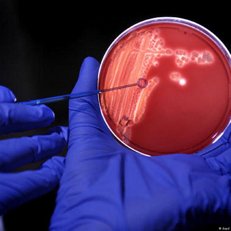 دراسة: بكتيريا تسوس الأسنان قد تسبب مرض باركنسون