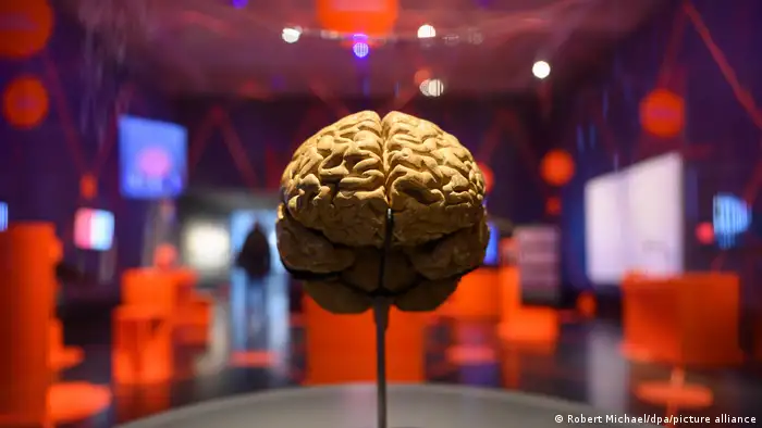 A large model of a brain is mounted on a stick with red display boxes visible in the distance behind it.