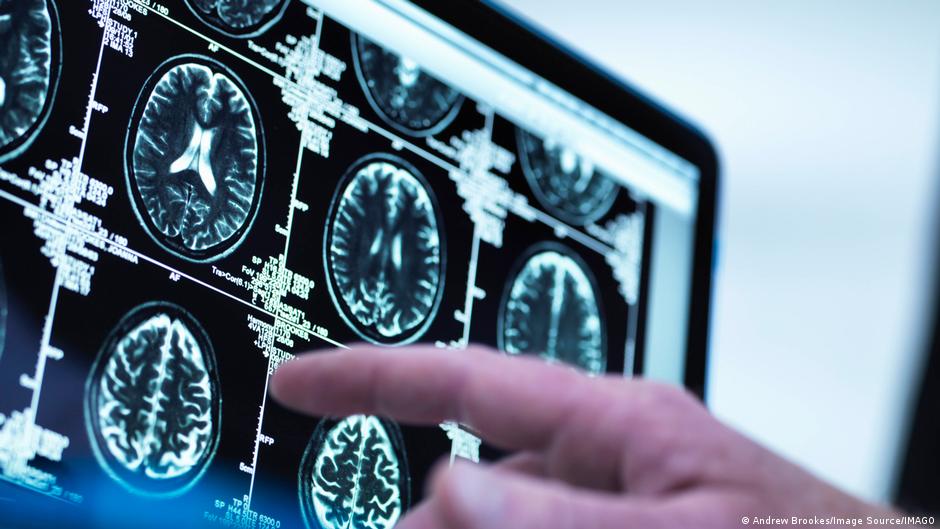 El cerebro atraviesa por cinco 'etapas' en la vida, dicen científicos