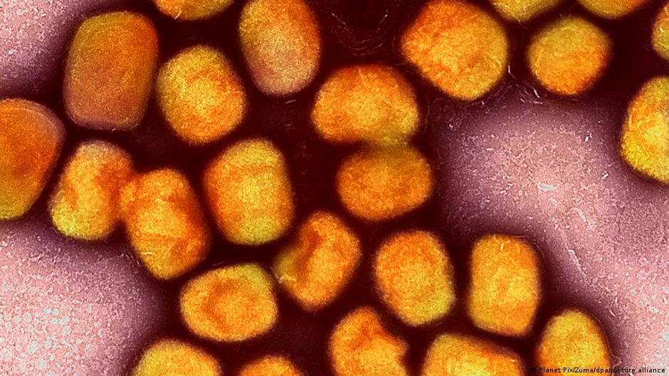 WHO hebt Gesundheitsnotstand wegen Affenpocken auf