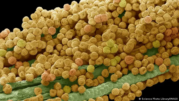 Pflanzenpollen unter dem Mikroskop (Quelle: Science Photo Library/IMAGO)