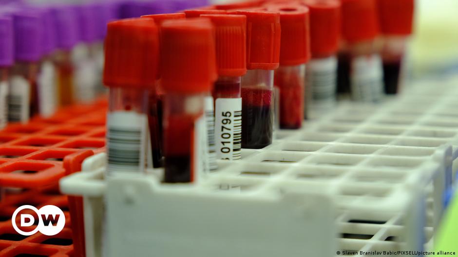 Neuer Bluttest verrät das Alter deiner Organe