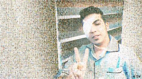 پارسا قبادی از آسیب دیدگان چشمی در اعتراضات پارسا قبادی از آسیب دیدگان چشمی در اعتراضات