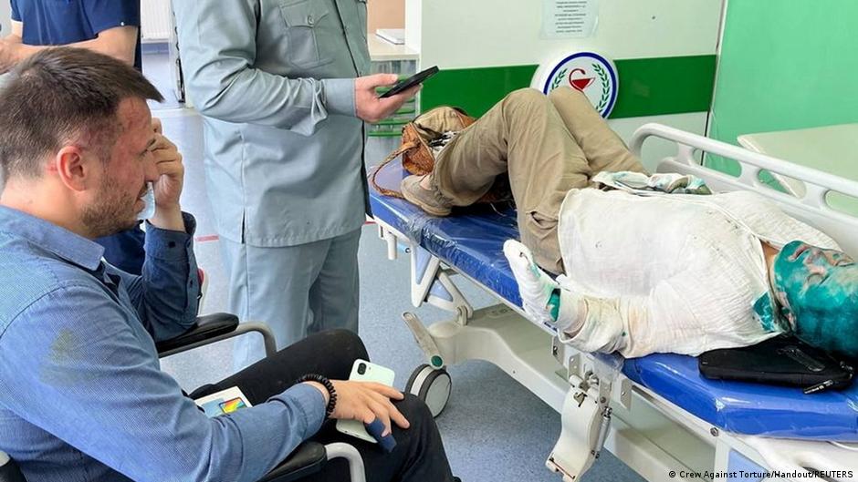 Russian journalist back in Moscow after Chechnya attack – DW – 07/05/2023 - Vimarsana News