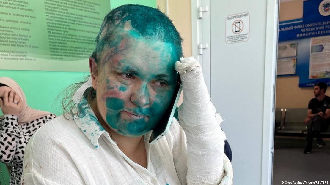 Elena Milashina speaks on the phone at a hospital after she and lawyer Alexander Nemov were attacked