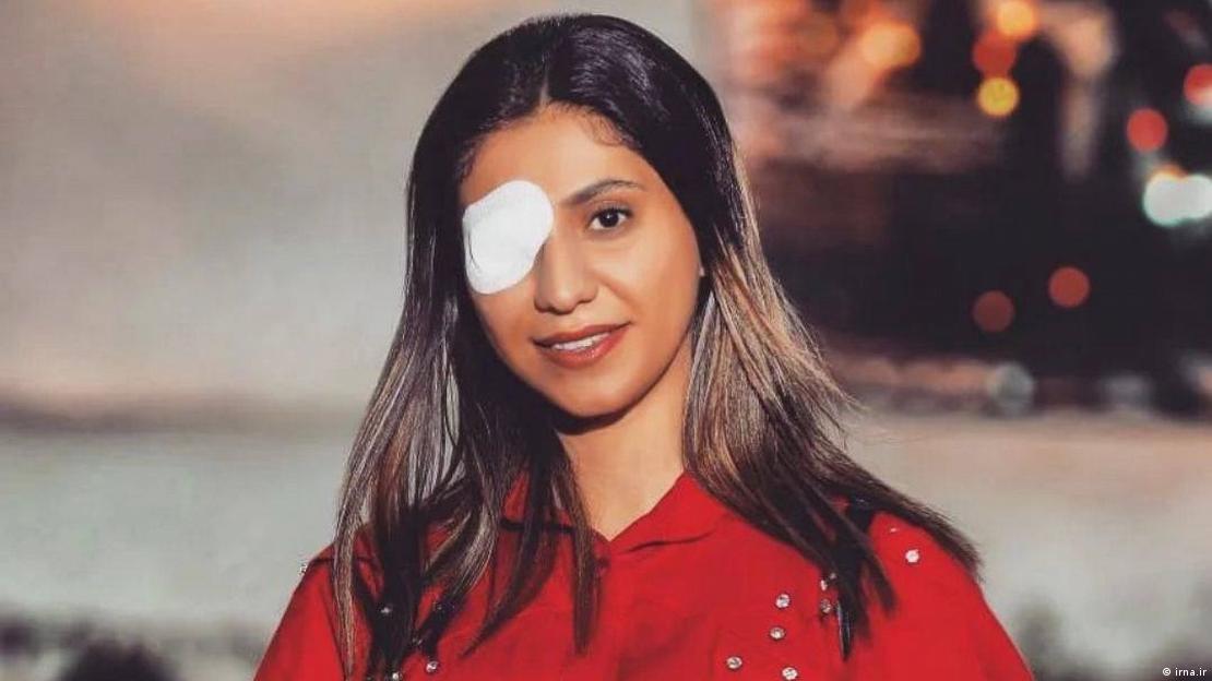 کوثر افتخاری با بانداژی بر چشم آسیبدیدهاش