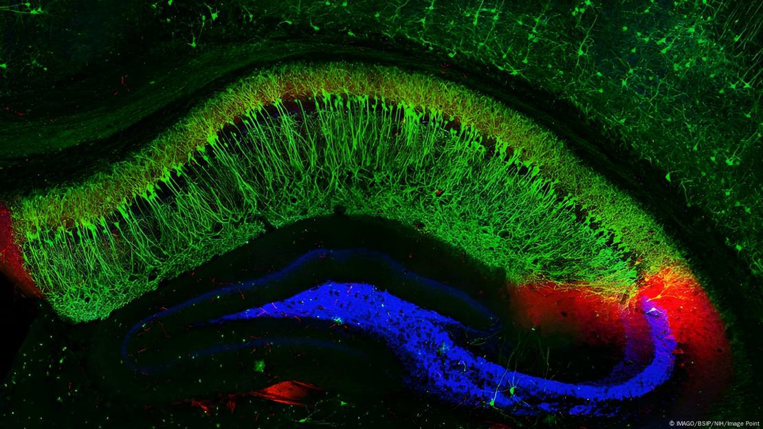 Cross-section of a mouse hippocampus