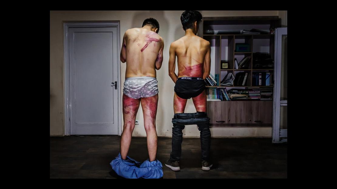 Sırtı dönük, vücudunda şiddet izleri olan iki erkek