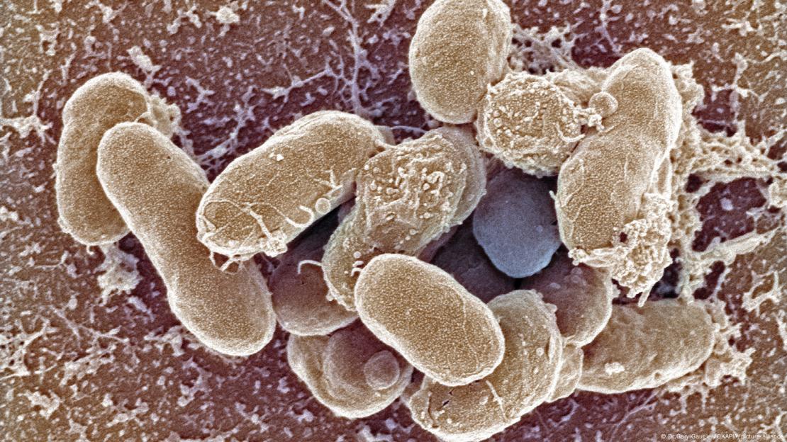 Kolera ve vibriosis gibi hastalıklara neden olan Vibrio bakterisinin mikroskopla görülebilen hali 