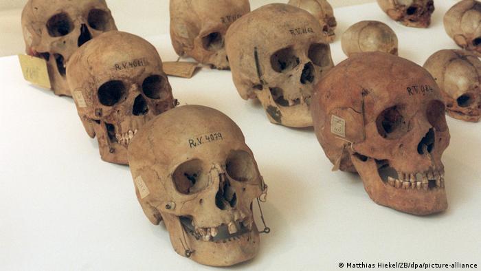 Crânios da coleção antropológica de Rudolf Virchow, em Dresden