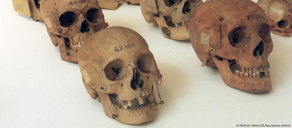 Crânios da coleção antropológica de Rudolf Virchow, em Dresden