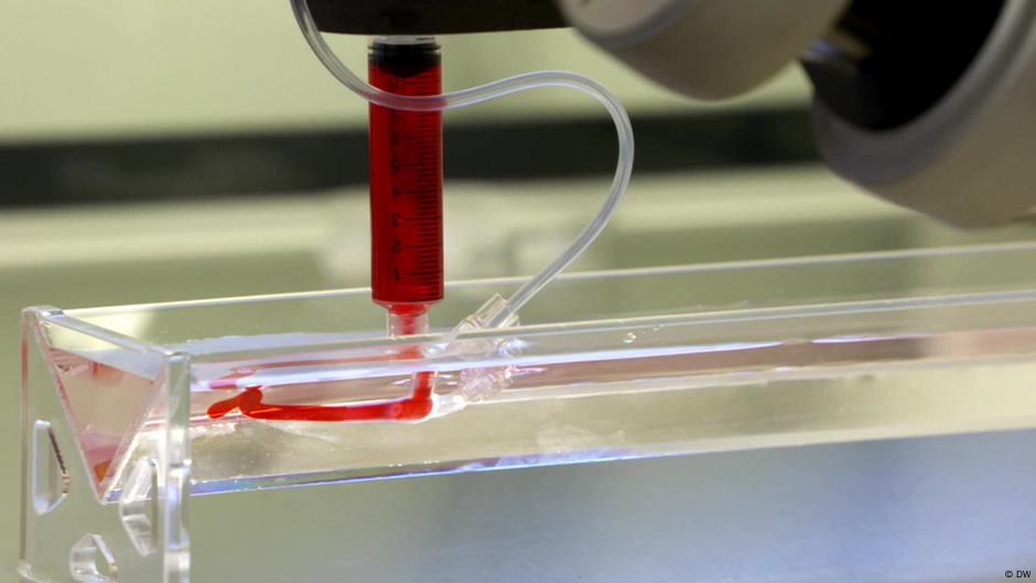 Heart bypasses: Soon done by 3D printers? – DW – 02/23/2024