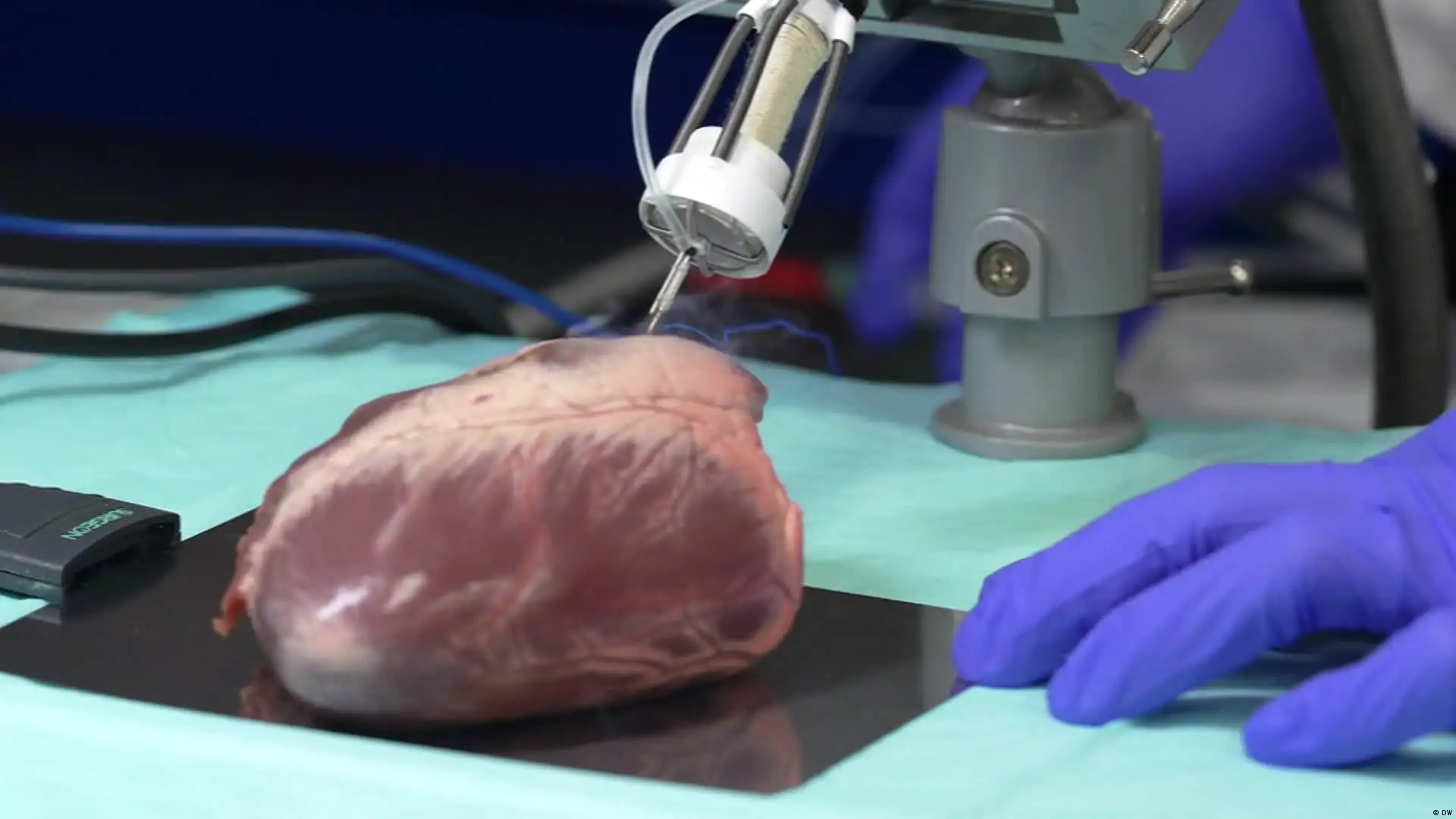 Bioprinting: 3D printing with living cells