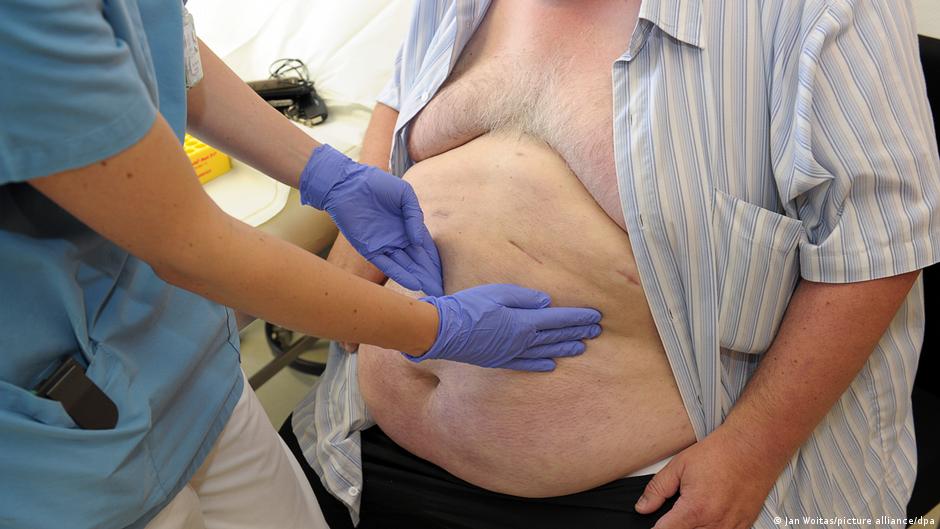 Masna jetra, koja nije posledica alkohola, danas je najčešća bolest jetre u Nemačkoj