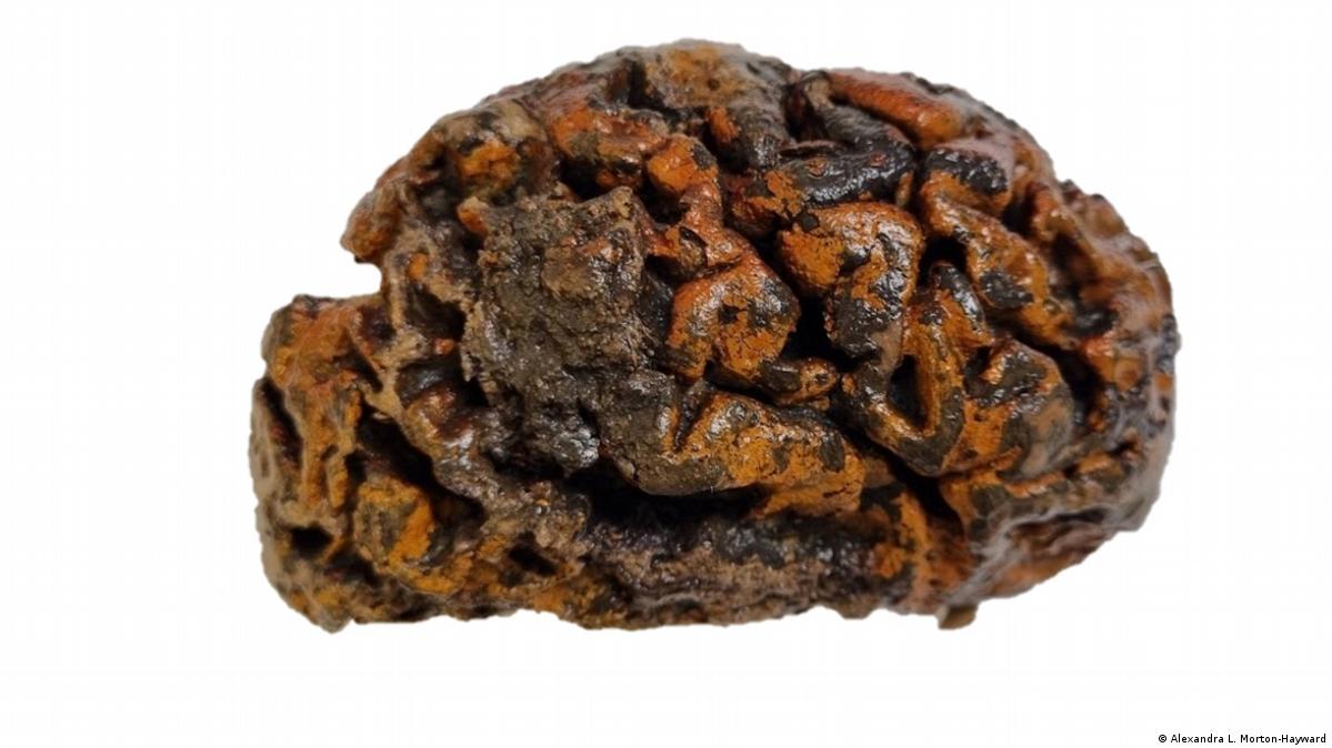 Hallan cerebros humanos que resisten la descomposición – DW – 20/03/2024